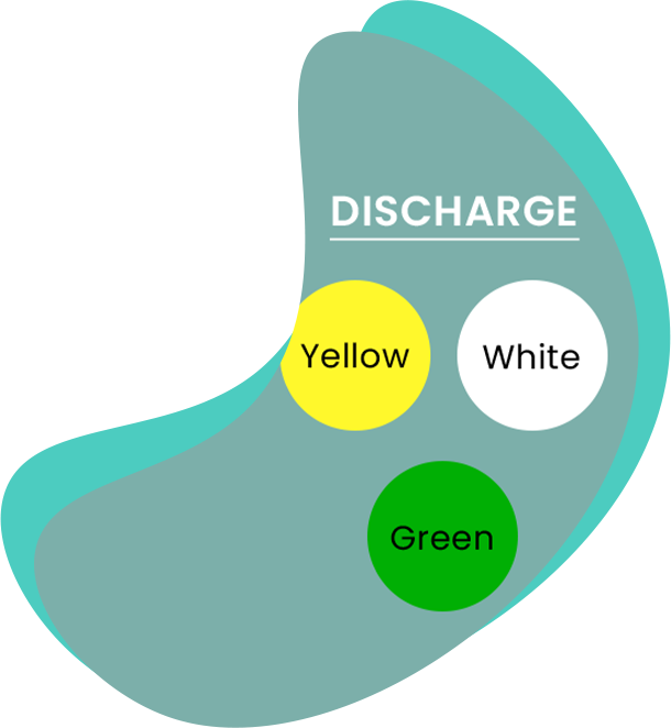 Yellow, White, or Green Discharge